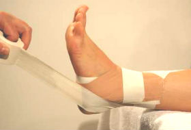 ankle-taping